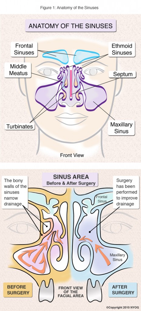 Sinus Anatomy: Check Out This Helpful Diagram - NY Sinus Center