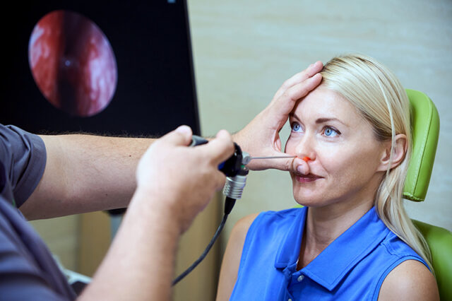 Signs of Nasal Polyps