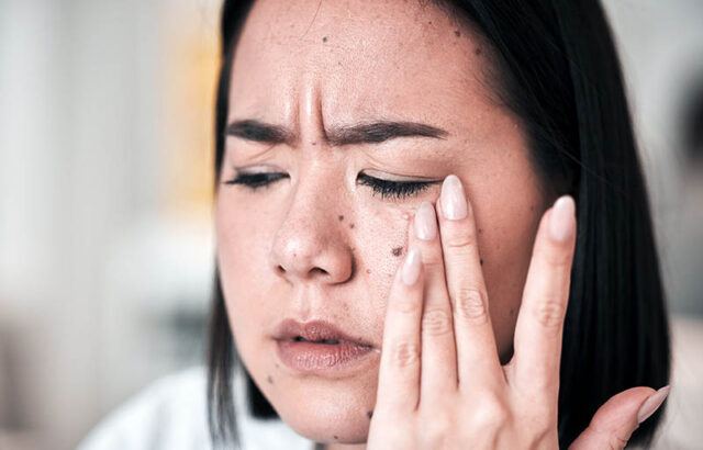 Balloon Sinuplasty Candidate